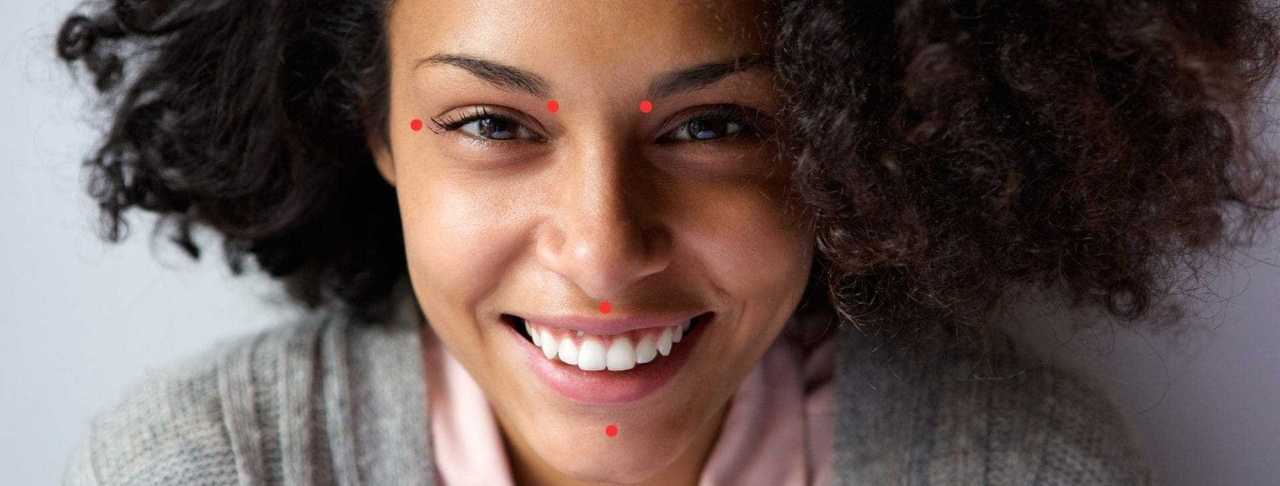 A person with curly hair smiles at the camera. Red dots are marked on their forehead, cheeks, upper lip, and chin.